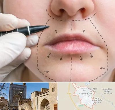 عمل سانترال لب در تربت جام