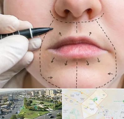 عمل سانترال لب در کمال شهر کرج