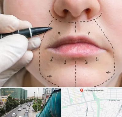 عمل سانترال لب در بلوار فرحزادی