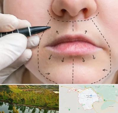 عمل سانترال لب در بهبهان