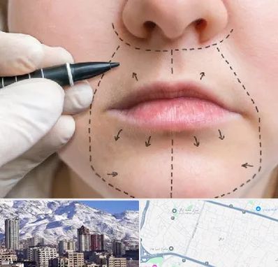 عمل سانترال لب در ازگل