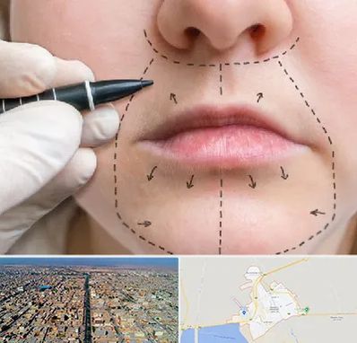 عمل سانترال لب در بندر ماهشهر