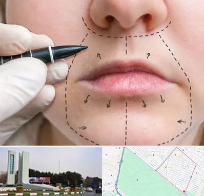 عمل سانترال لب در بلوار فلسیطین مشهد