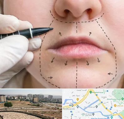 عمل سانترال لب در کوی وحدت شیراز