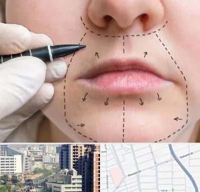 عمل سانترال لب در خیابان بهشتی