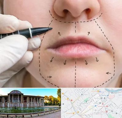 عمل سانترال لب در عفیف آباد شیراز