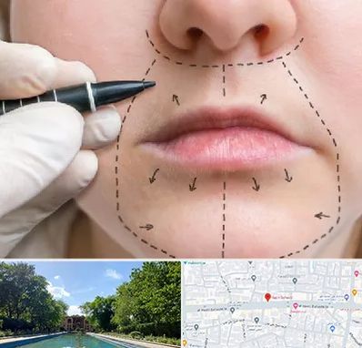 عمل سانترال لب در هشت بهشت اصفهان