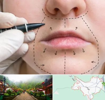 عمل سانترال لب در فومن