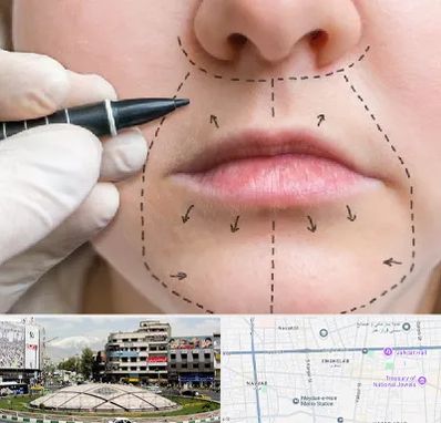 عمل سانترال لب در مرکز تهران