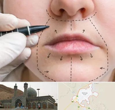 عمل سانترال لب در شهرضا