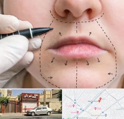 عمل سانترال لب در باجک قم