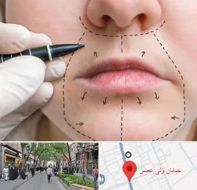 عمل سانترال لب در ولیعصر شهریار