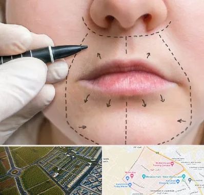 عمل سانترال لب در الهیه مشهد