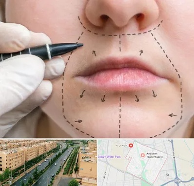عمل سانترال لب در فاز سه اندیشه