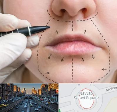 عمل سانترال لب در نواب