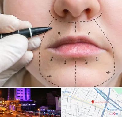 عمل سانترال لب در آبرسان تبریز