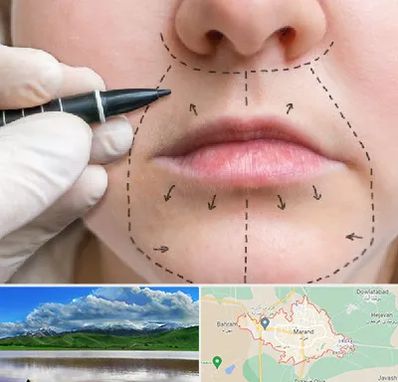 عمل سانترال لب در مرند