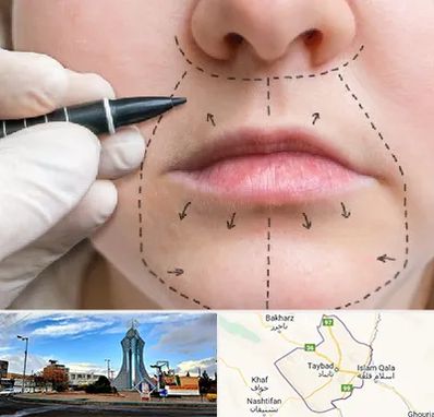 عمل سانترال لب در تایباد