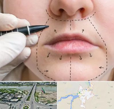 عمل سانترال لب در میاندوآب