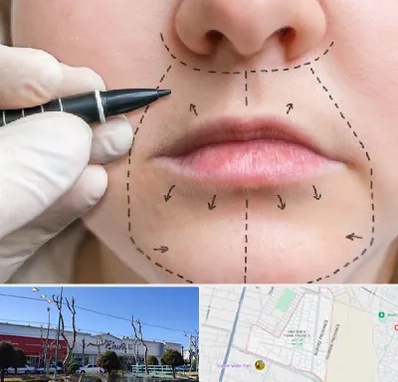 عمل سانترال لب در فاز دو اندیشه