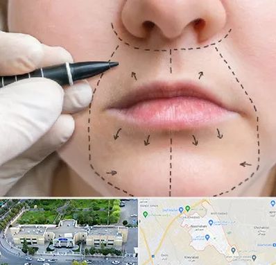 عمل سانترال لب در نسیم شهر