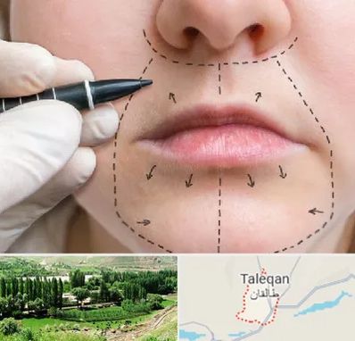 عمل سانترال لب در طالقان