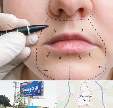 عمل سانترال لب در فردوسیه شهریار