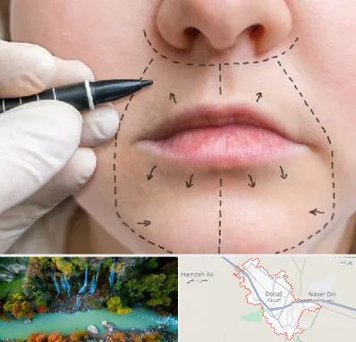 عمل سانترال لب در دورود