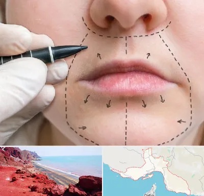 عمل سانترال لب در هرمزگان