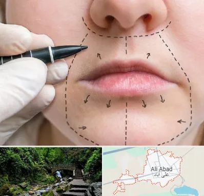 عمل سانترال لب در علی آباد کتول