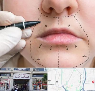 عمل سانترال لب در ایران زمین