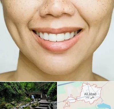 عمل چال گونه در علی‌ آباد کتول