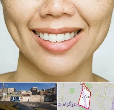 عمل چال گونه در اتابک