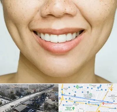 عمل چال گونه در فرجام