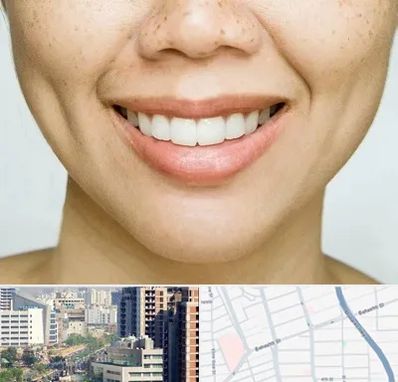 عمل چال گونه در خیابان بهشتی