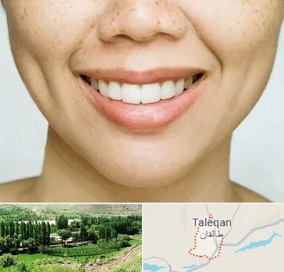 عمل چال گونه در طالقان