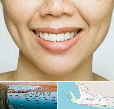 عمل چال گونه در چابهار