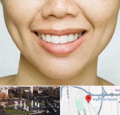 عمل چال گونه در آرژانتین
