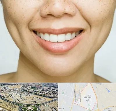 عمل چال گونه در اندیشه