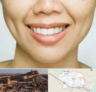 عمل چال گونه در بم