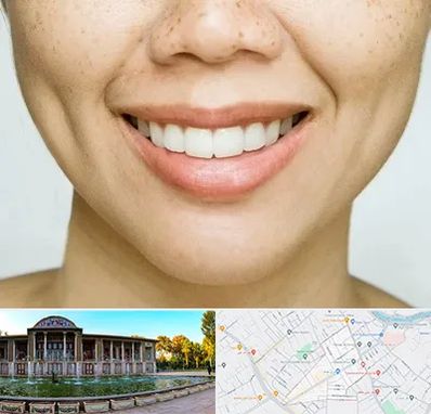 عمل چال گونه در عفیف آباد شیراز