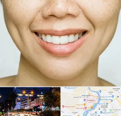 عمل چال گونه در کیانپارس اهواز