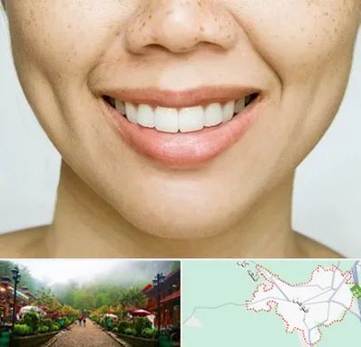 عمل چال گونه در فومن