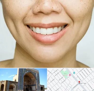 عمل چال گونه در مصلی مشهد