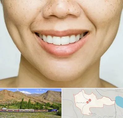 عمل چال گونه در خاش