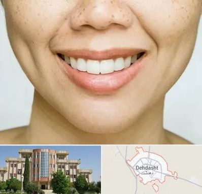 عمل چال گونه در دهدشت