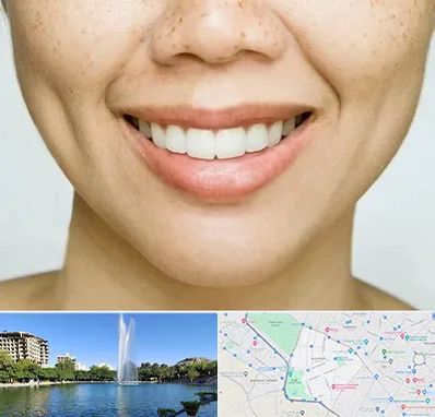 عمل چال گونه در کوهسنگی مشهد