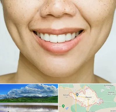 عمل چال گونه در مرند