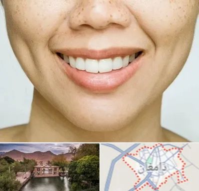 عمل چال گونه در دامغان