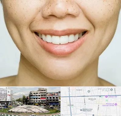 عمل چال گونه در مرکز تهران